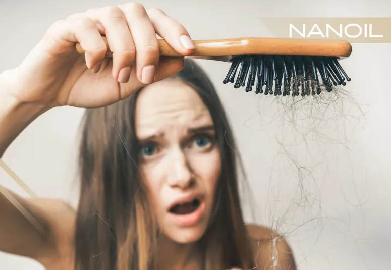 Causas tras la caída del pelo. ¿Cómo aumentar el volumen y evitar la caída del cabello?